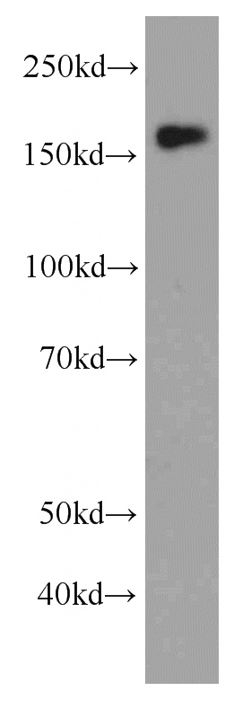 HEK-293 cells were subjected to SDS PAGE followed by western blot with Catalog No:107431(MSH6 Antibody) at dilution of 1:1000