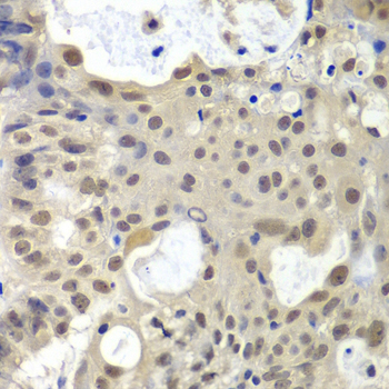 Immunohistochemistry - U2AF1 Polyclonal Antibody 