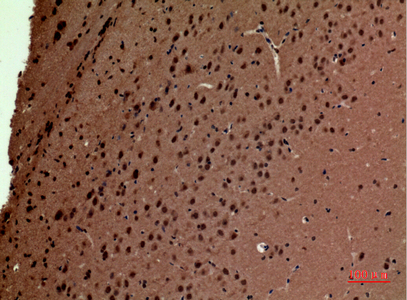 Fig2:; Immunohistochemical analysis of paraffin-embedded mouse-brain, antibody was diluted at 1:100