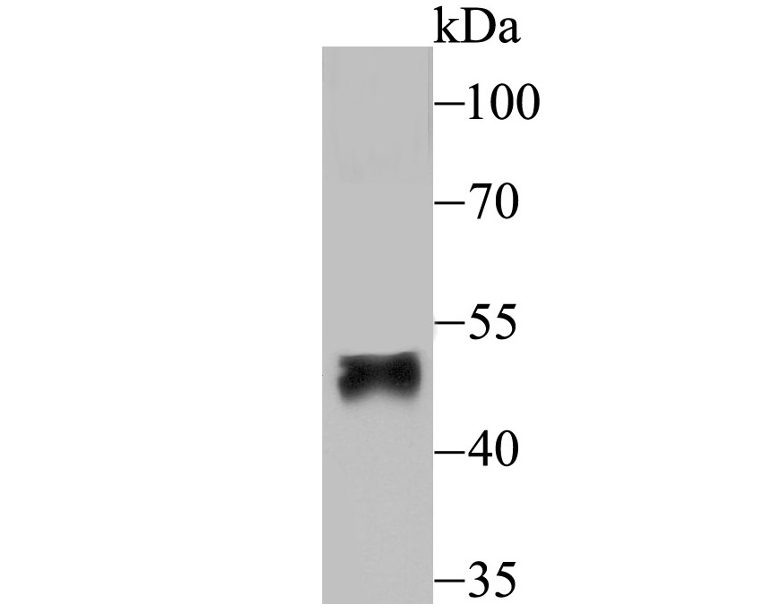 Fig1: Western blot analysis of FOXF2 on human placenta tissue lysate using anti-FOXF2 antibody at 1/200 dilution.