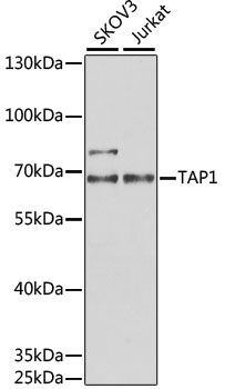 Western blot - TAP1 Polyclonal Antibody 