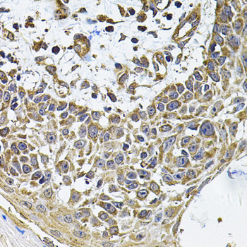 Immunohistochemistry - ICOSLG Polyclonal Antibody 