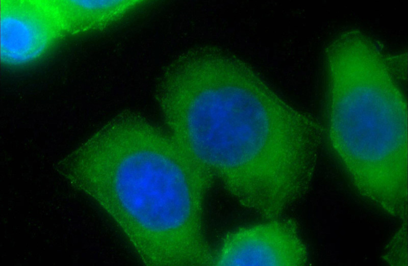 Immunofluorescent analysis of HeLa cells using Catalog No:113503(PALLD,palladin Antibody) at dilution of 1:50 and Alexa Fluor 488-congugated AffiniPure Goat Anti-Rabbit IgG(H+L)