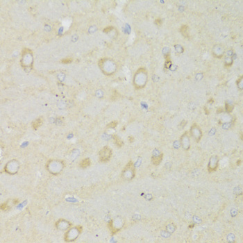 Immunohistochemistry - TRAP1 Polyclonal Antibody 