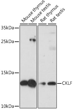 Western blot - CKLF Polyclonal Antibody 