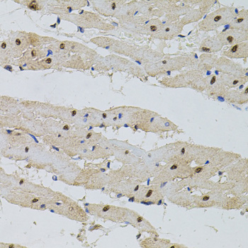 Immunohistochemistry - POP4 Polyclonal Antibody 
