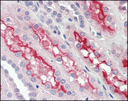 Immunohistochemical analysis of paraffin-embedded human kidney tissues using FER mouse mAb.