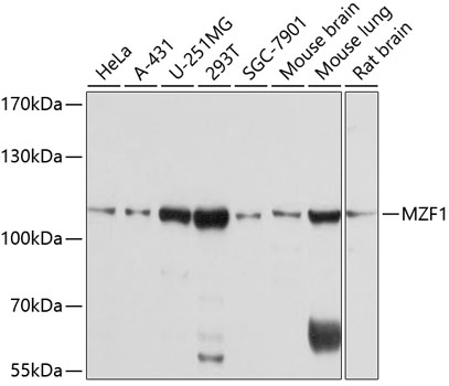 Western blot - MZF1 Polyclonal Antibody 