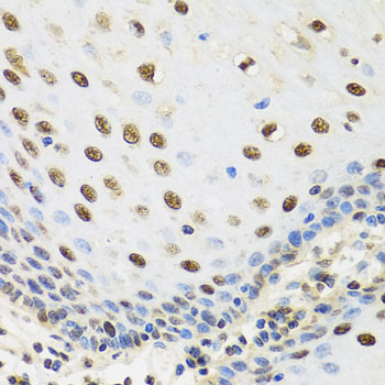 Immunohistochemistry - TAF15 Polyclonal Antibody 