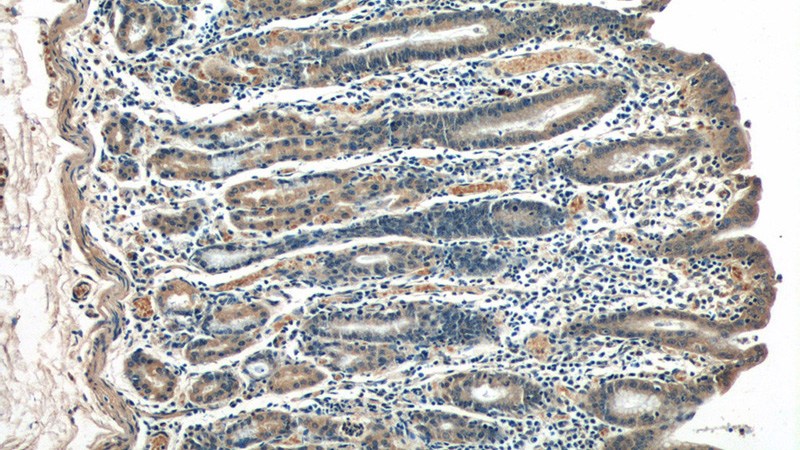 Immunohistochemistry of paraffin-embedded human stomach tissue slide using Catalog No:107921(JUB Antibody) at dilution of 1:50 (under 10x lens)
