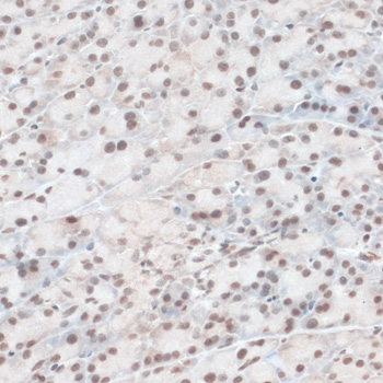 Immunohistochemistry - ZNF574 Polyclonal Antibody 