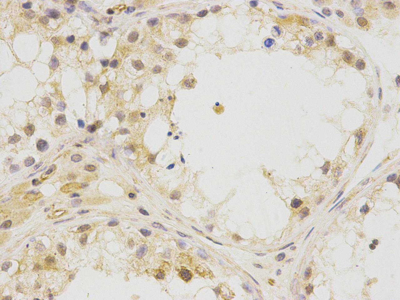Fig2: Immunohistochemical analysis of paraffin-embedded human testis tissue using anti- BNC1 rabbit polyclonal antibody.