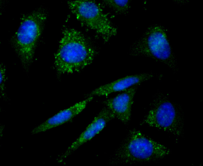 Fig2:; ICC staining of Protein Kinase D2 in SH-SY5Y cells (green). Formalin fixed cells were permeabilized with 0.1% Triton X-100 in TBS for 10 minutes at room temperature and blocked with 1% Blocker BSA for 15 minutes at room temperature. Cells were probed with the primary antibody ( 1/50) for 1 hour at room temperature, washed with PBS. Alexa Fluor®488 Goat anti-Rabbit IgG was used as the secondary antibody at 1/1,000 dilution. The nuclear counter stain is DAPI (blue).
