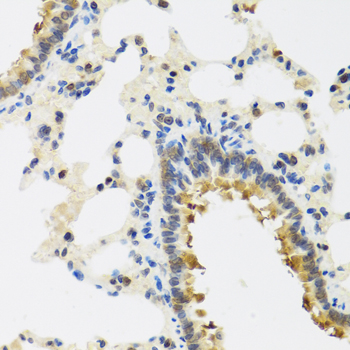 Immunohistochemistry - CRTAP Polyclonal Antibody 