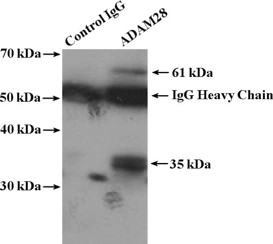 IP Result of anti-ADAM28 (IP:Catalog No:107766, 4ug; Detection:Catalog No:107766 1:800) with mouse lung tissue lysate 3600ug.