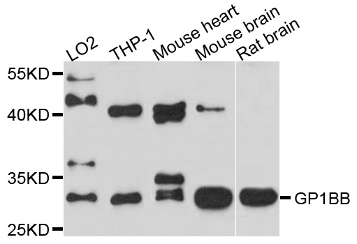 Western blot - GP1BB Polyclonal Antibody 