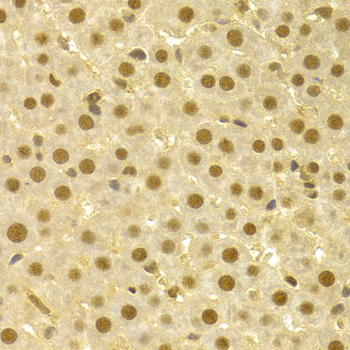 Immunohistochemistry - CDC25A Polyclonal Antibody 