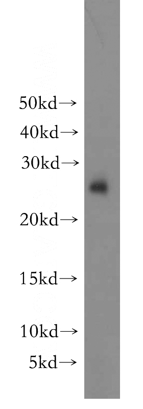 human brain tissue were subjected to SDS PAGE followed by western blot with Catalog No:116898(YWHAH antibody) at dilution of 1:300