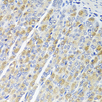 Immunohistochemistry - OSGEPL1 Polyclonal Antibody 