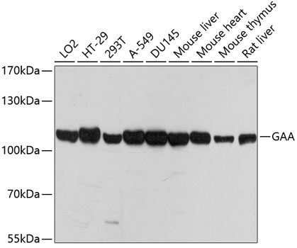 Western blot - GAA Polyclonal Antibody 