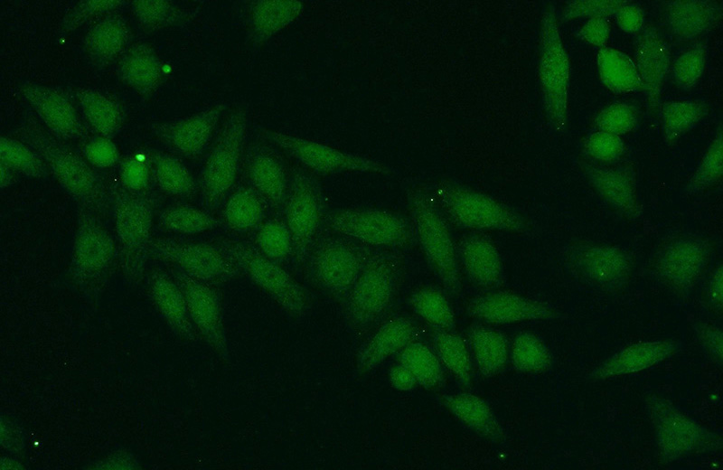 Immunofluorescent analysis of HeLa cells using Catalog No:115743(SUPT7L Antibody) at dilution of 1:50 and Alexa Fluor 488-congugated AffiniPure Goat Anti-Rabbit IgG(H+L)