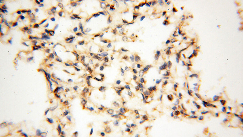 Immunohistochemical of paraffin-embedded human lung using Catalog No:112492(MAT1A antibody) at dilution of 1:200 (under 40x lens)