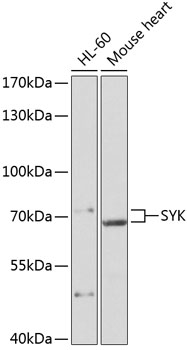 Western blot - SYK Polyclonal Antibody 