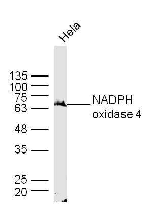 Fig3: Sample: Hela Cell Lysate at 40 ug; Primary: Anti- NADPH oxidase 4 at 1/300 dilution; Secondary: IRDye800CW Goat Anti-Rabbit IgG at 1/20000 dilution; Predicted band size: 64 kD; Observed band size: 64 kD