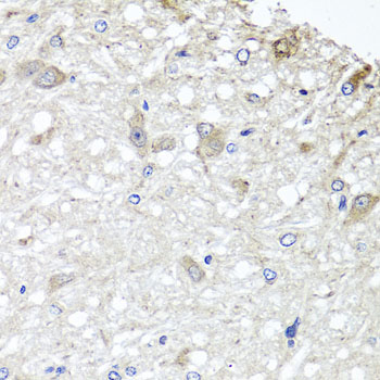 Immunohistochemistry - METTL13 Polyclonal Antibody 