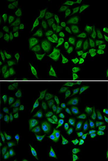 Immunofluorescence - NDUFS1 Polyclonal Antibody 