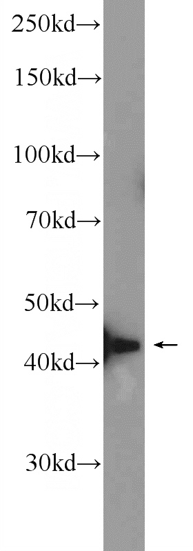 mouse testis tissue were subjected to SDS PAGE followed by western blot with Catalog No:116942(ZMYND12 Antibody) at dilution of 1:600