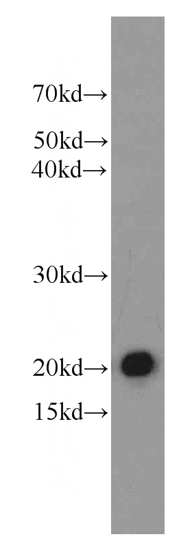 mouse heart tissue were subjected to SDS PAGE followed by western blot with Catalog No:109786(CYGB antibody) at dilution of 1:1500