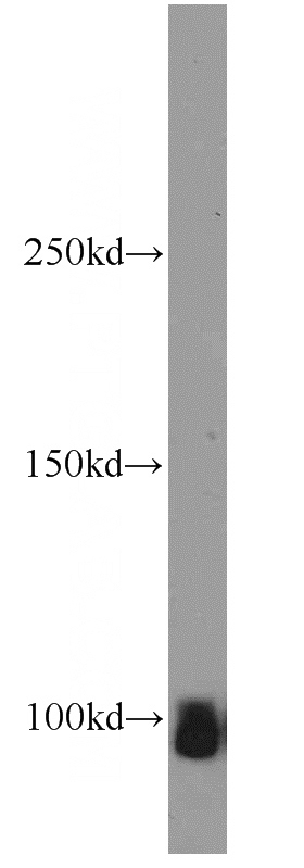 mouse brain tissue were subjected to SDS PAGE followed by western blot with Catalog No:108343(ATP1A2 antibody) at dilution of 1:800