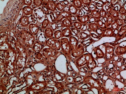 Fig1:; Immunohistochemical analysis of paraffin-embedded Human-kidney, antibody was diluted at 1:100