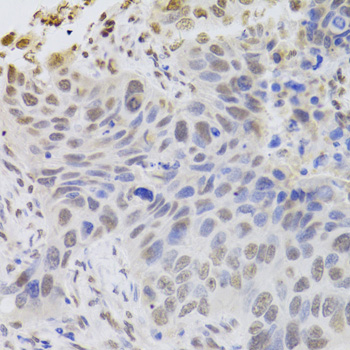 Immunohistochemistry - HDGF Polyclonal Antibody 