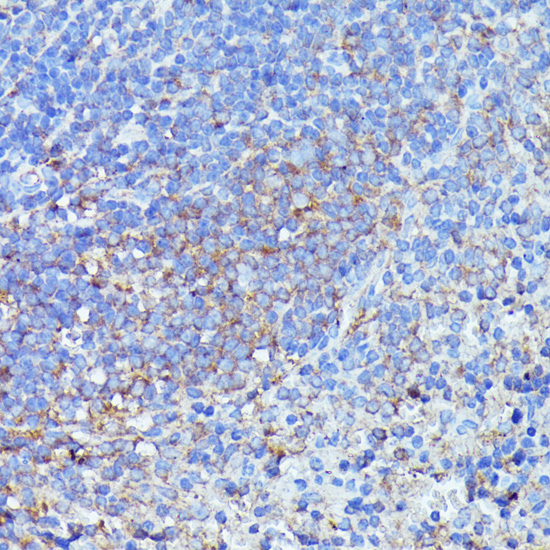 Immunohistochemistry - SEPT1 Polyclonal Antibody 