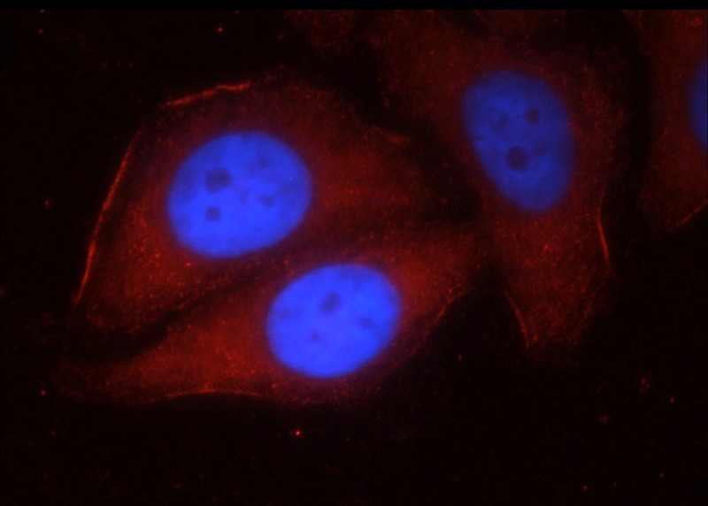 Immunofluorescent analysis of HepG2 cells using Catalog No:111022(GLI3-Specific Antibody) at dilution of 1:25 and Rhodamine-Goat anti-Rabbit IgG