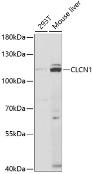 Western blot - CLCN1 Polyclonal Antibody 