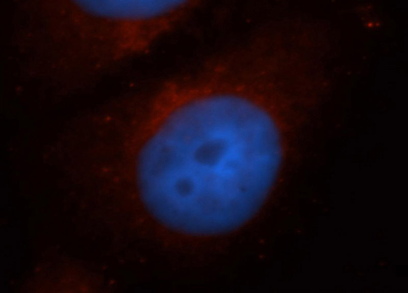 Immunofluorescent analysis of HepG2 cells, using COL3A1 antibody Catalog No:109378 at 1:50 dilution and Rhodamine-labeled goat anti-rabbit IgG (red). Blue pseudocolor = DAPI (fluorescent DNA dye).