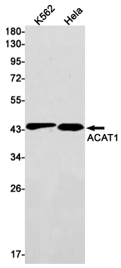 Western blot detection of ACAT1 in K562,Hela cell lysates using ACAT1 Rabbit mAb(1:1000 diluted).Predicted band size:45kDa.Observed band size:45kDa.