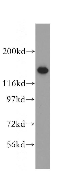 A549 cells were subjected to SDS PAGE followed by western blot with Catalog No:109072(CCP1 antibody) at dilution of 1:500