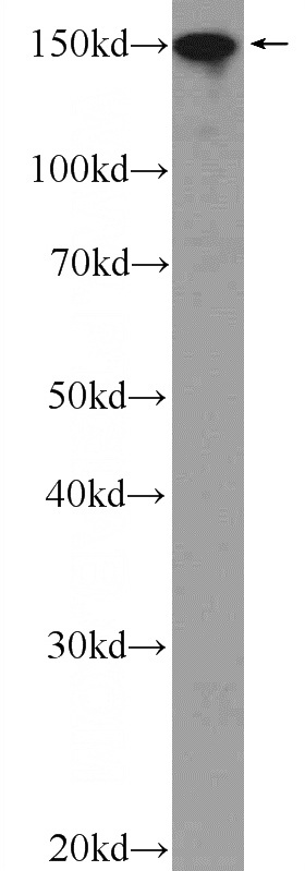 HeLa cells were subjected to SDS PAGE followed by western blot with Catalog No:116464(UACA Antibody) at dilution of 1:2000