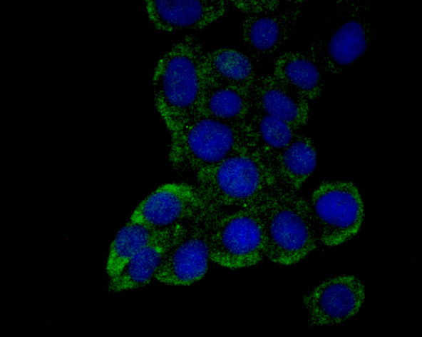 Fig1: ICC staining Emi1 in LOVO cells (green). The nuclear counter stain is DAPI (blue). Cells were fixed in paraformaldehyde, permeabilised with 0.25% Triton X100/PBS.