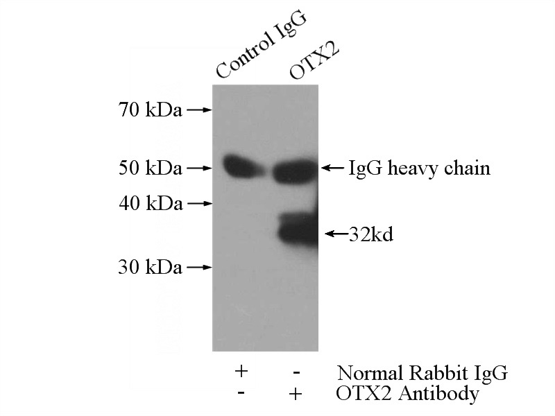 IP Result of anti-OTX2 (IP:Catalog No:113519, 3ug; Detection:Catalog No:113519 1:1500) with Y79 cells lysate 2400ug.