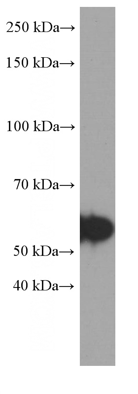 SH-SY5Y cells were subjected to SDS PAGE followed by western blot with Catalog No:107622(TH Antibody) at dilution of 1:2000