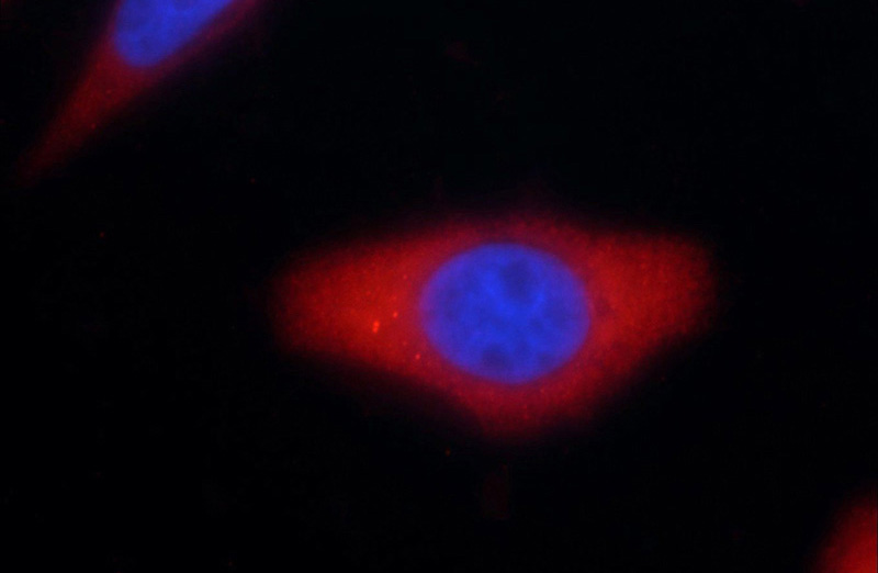 Immunofluorescent analysis of HepG2 cells using Catalog No:116741(C14orf115 Antibody) at dilution of 1:25 and Rhodamine-Goat anti-Rabbit IgG
