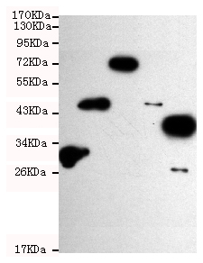 Western blot detection of His-tag in various bacterial lysates,which containing His-tagged proteins (MW: 30 kDa,45 kDa,72 kDa,44 kDa and 40 kDa respectively) using anti-his antibody (1:1000 diluted).