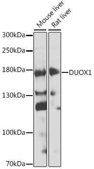 Western blot - DUOX1 Polyclonal Antibody 
