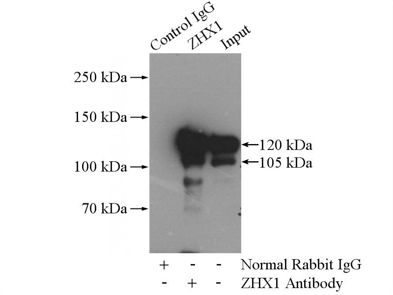 IP Result of anti-ZHX1 (IP:Catalog No:117052, 4ug; Detection:Catalog No:117052 1:500) with HEK-293 cells lysate 3200ug.