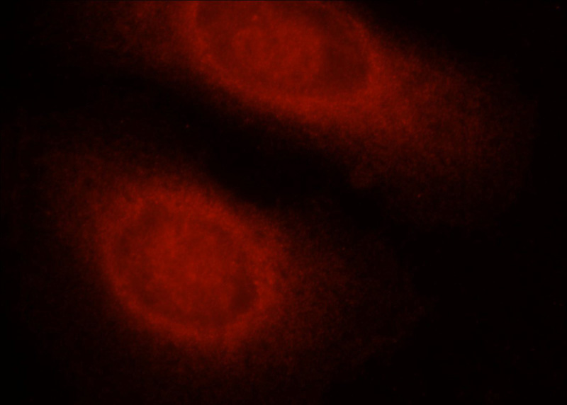 Immunofluorescent analysis of HepG2 cells using Catalog No:108879(Caspase 8 Antibody) at dilution of 1:25 and Rhodamine-Goat anti-Rabbit IgG